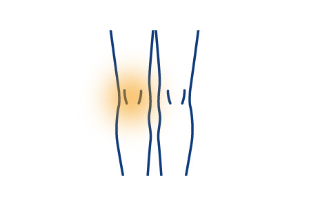 膝が痛い、曲がらないなどの症状でお悩みの方へ